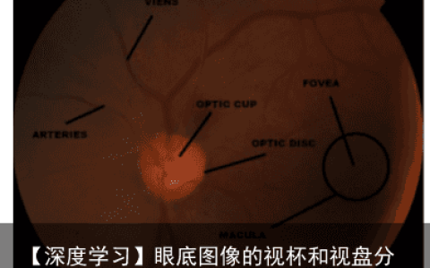 【深度学习】眼底图像的视杯和视盘分割解析