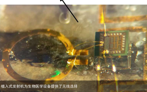 植入式发射机为生物医学设备提供了无线选择